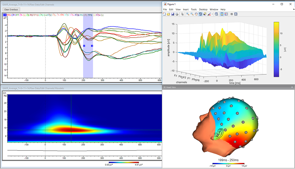 Brain Vision Analyzer Is An Easy To Use Eeg Software Package
