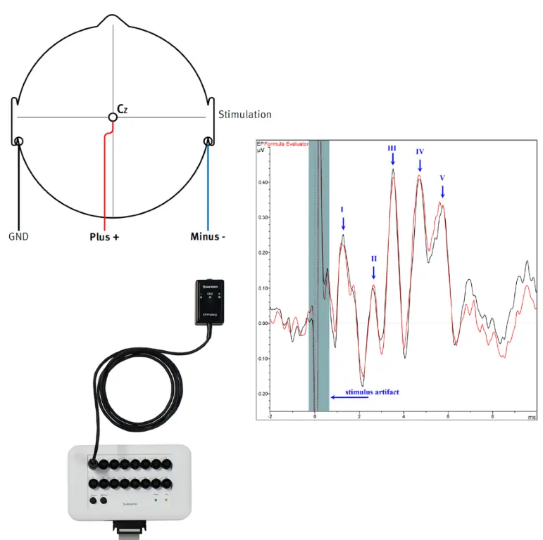 Diagram showing auditory brainstem response (ABR) setup: electrode placement over the scalp, a stimulation waveform with labeled peaks (I–V), and connected BrainAmp hardware with recording cable