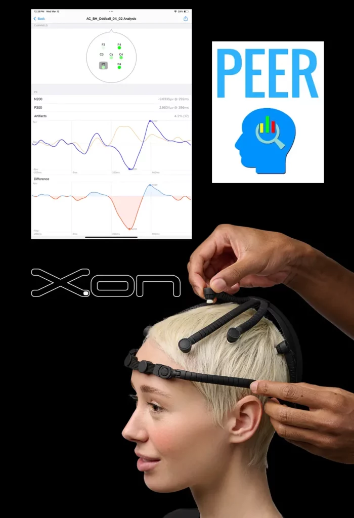 Hands adjusting a black X.on headset on a woman, with brainwave analysis and PEER logo displayed above