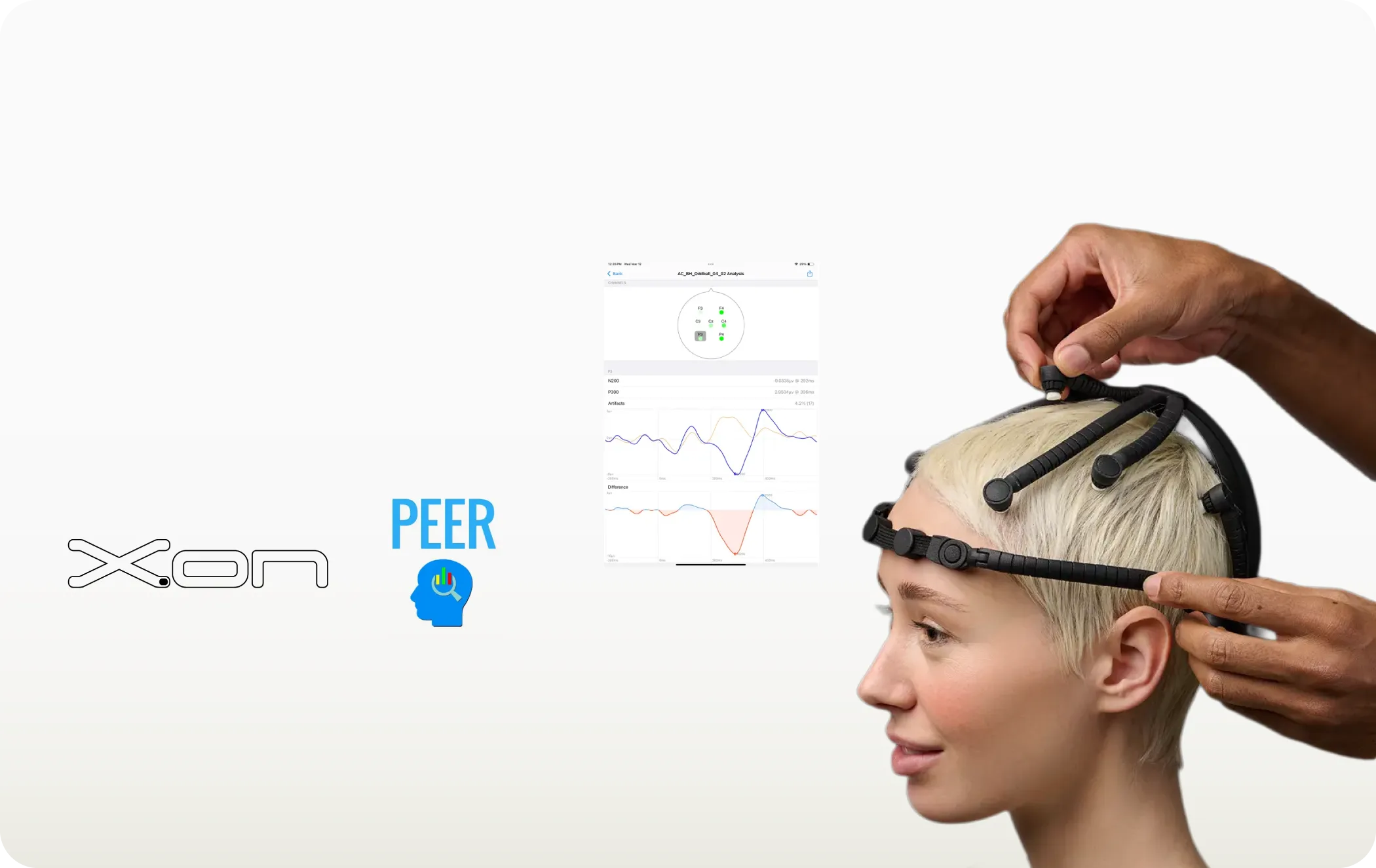 X.on EEG headset and PEER analysis app for neuroscience teaching